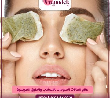 علاج الهالات السوداء بالأعشاب والطرق الطبيعية