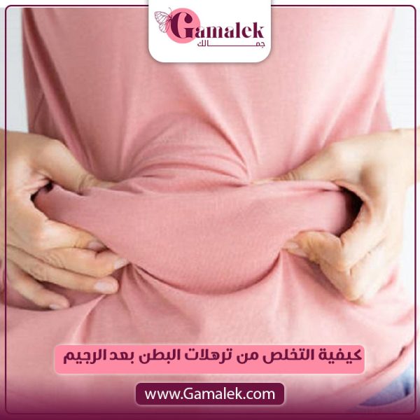 كيفية التخلص من ترهلات البطن بعد الرجيم؟