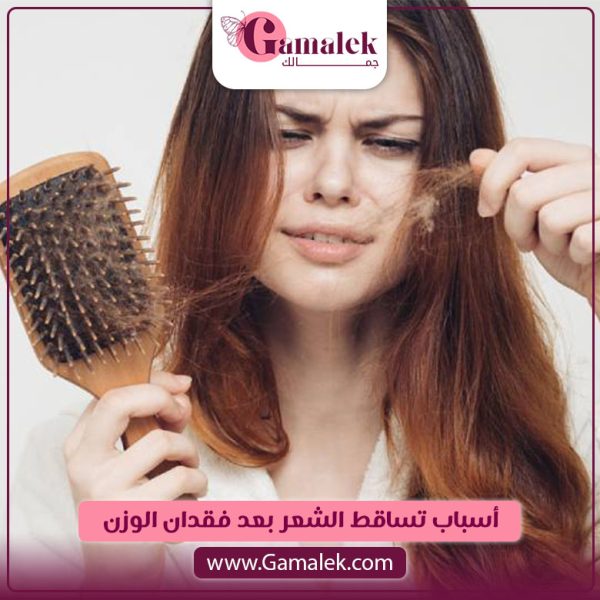 أسباب تساقط الشعر بعد فقدان الوزن