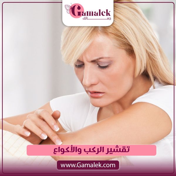 تقشير الركب والأكواع