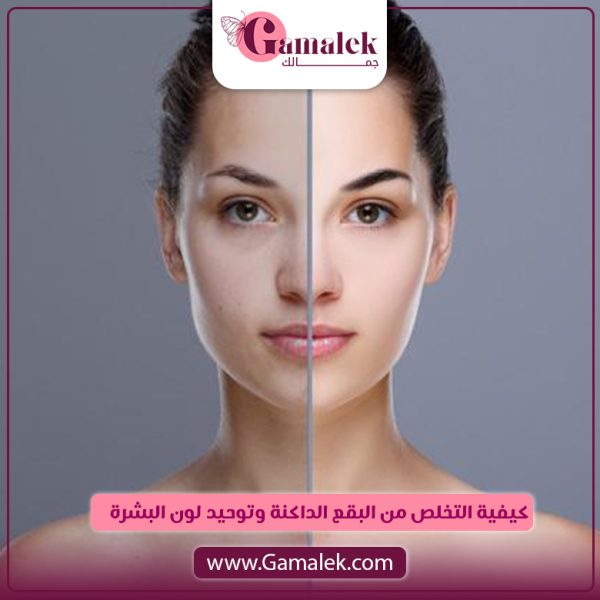 كيفية التخلص من البقع الداكنة وتوحيد لون البشرة