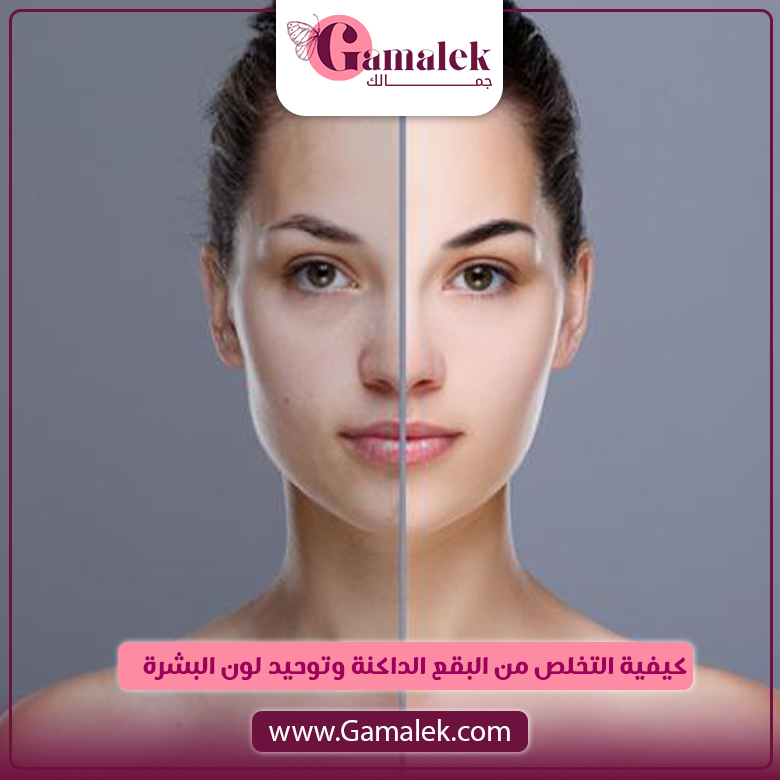 كيفية التخلص من البقع الداكنة وتوحيد لون البشرة