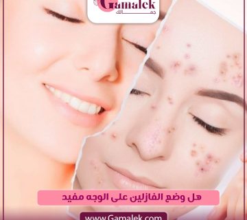 هل وضع الفازلين على الوجه مفيد؟