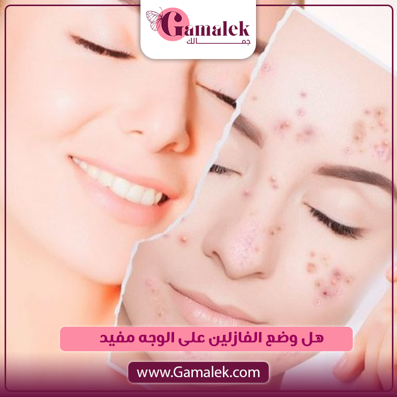 هل وضع الفازلين على الوجه مفيد؟