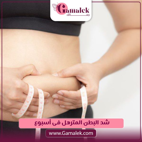 شد البطن المترهل في اسبوع