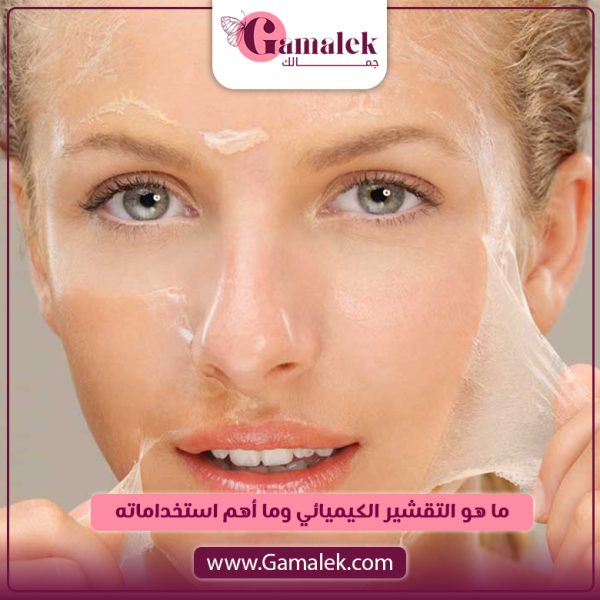 ما هو التقشير الكيميائي؟ وما أهم استخداماته؟