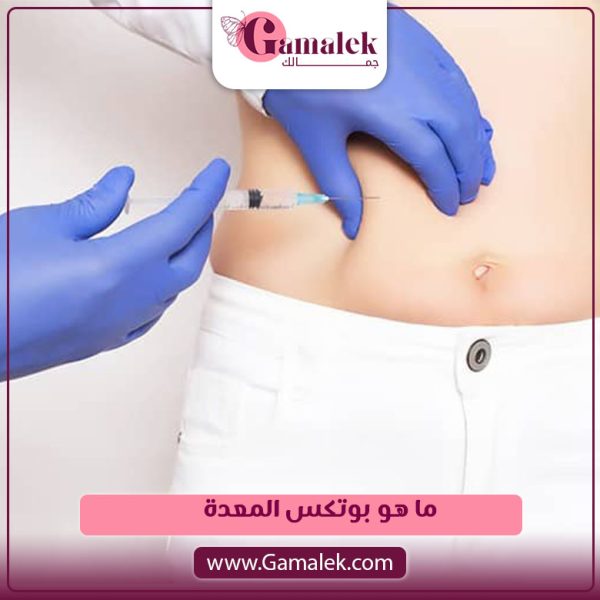 ما هو بوتكس المعدة؟