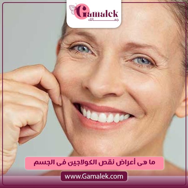 ما هي اعراض نقص الكولاجين في الجسم؟