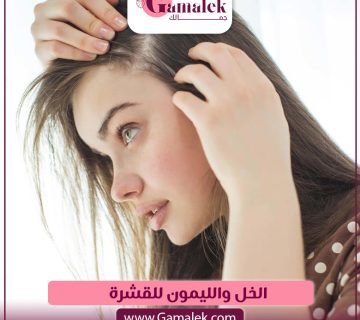 الخل والليمون للقشرة