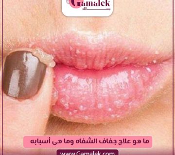 ما هو علاج جفاف الشفاه وما هي أسبابه؟