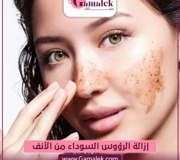 إزالة الرؤوس السوداء من الأنف