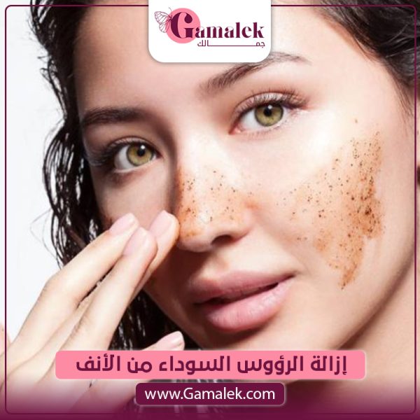إزالة الرؤوس السوداء من الأنف