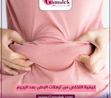 كيفية التخلص من ترهلات البطن بعد الرجيم